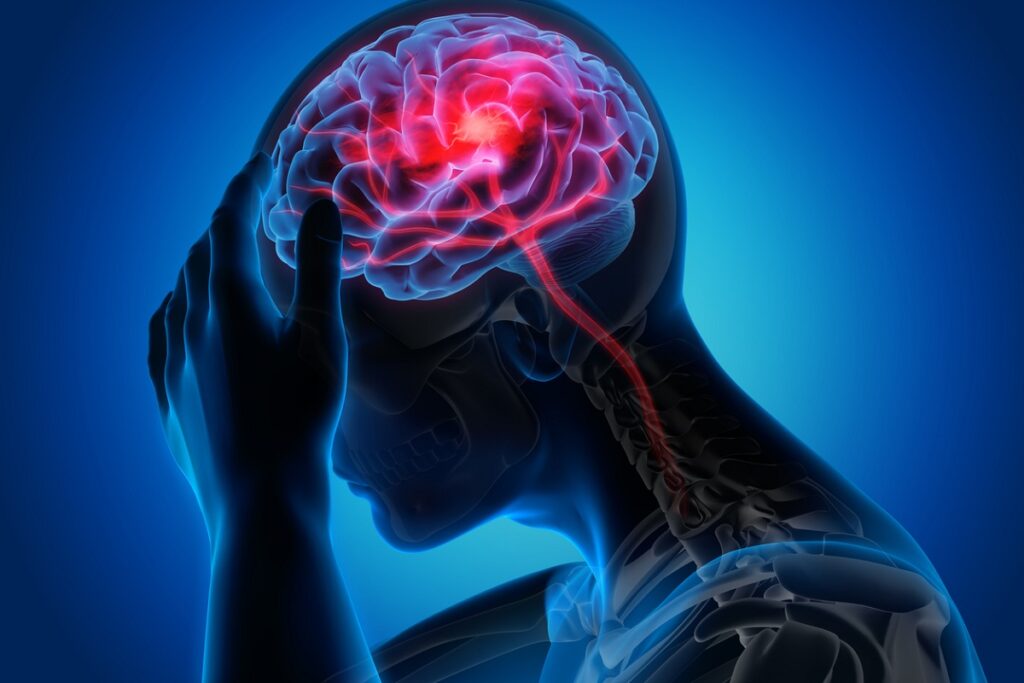 Types of Imaging Tests for Neurological Conditions