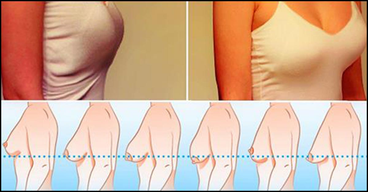 What you can do to prevent breast sagging post pregnancy - CK